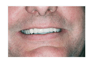 After Dental Care