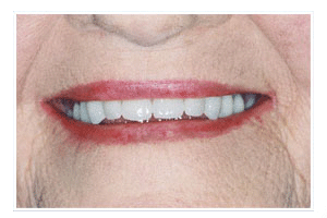 After Dental Care