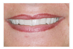 After Dental Care
