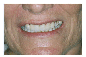 After Dental Care