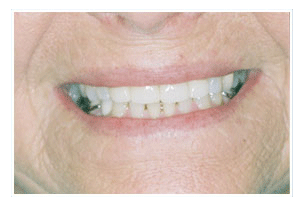 After Dental Care