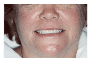After Dental Care