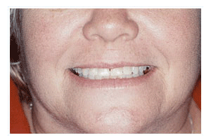 Before Dental Care