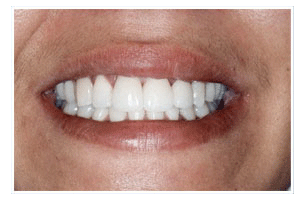 After Dental Care