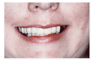 After Dental Care