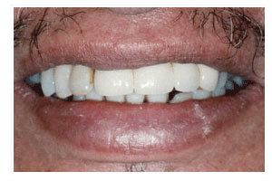 After Dental Care