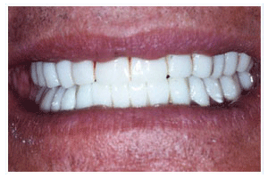 After Dental Care