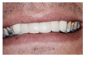 After Dental Care