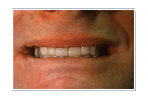 After Dental Care